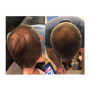 Elixir 100Ml Hair Growth Serum Biotin Regrowth Topical Scalp